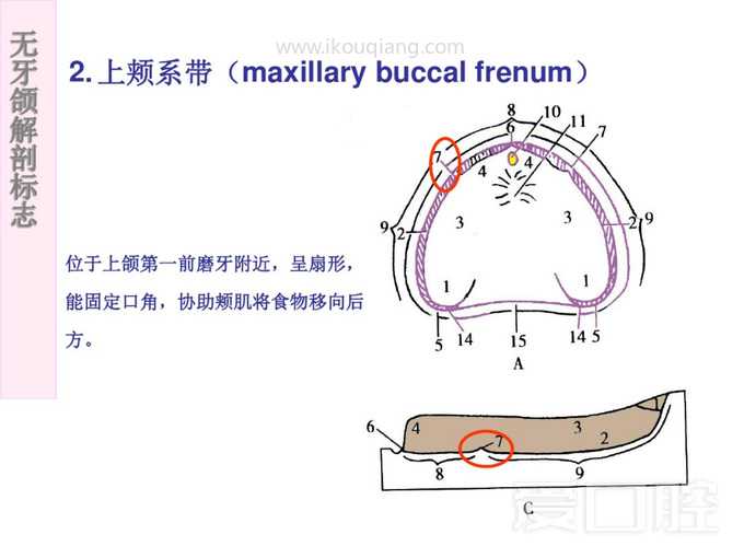 无牙颌解剖标志 4.jpg