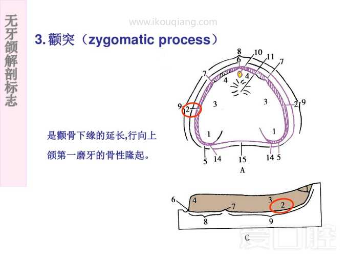 无牙颌解剖标志 6.jpg