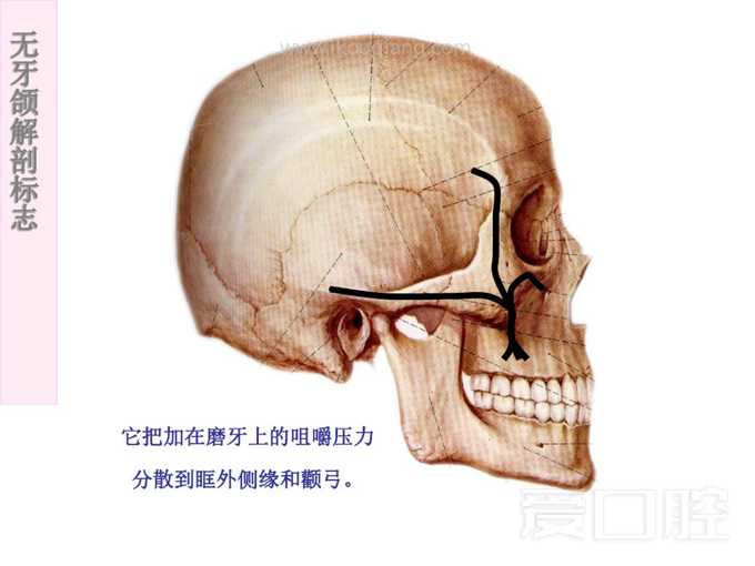 无牙颌解剖标志 7.jpg