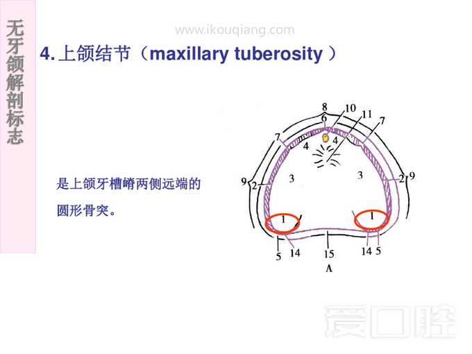 无牙颌解剖标志 9.jpg