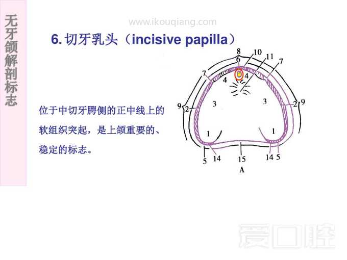 无牙颌解剖标志 14.jpg