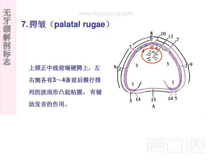 无牙颌解剖标志 17.jpg