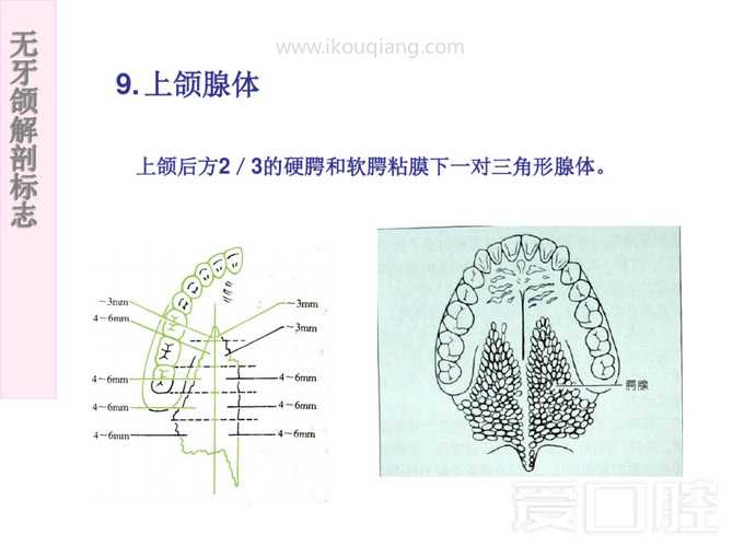 无牙颌解剖标志 21.jpg