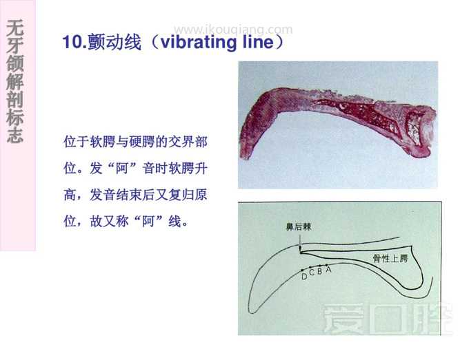 无牙颌解剖标志 23.jpg