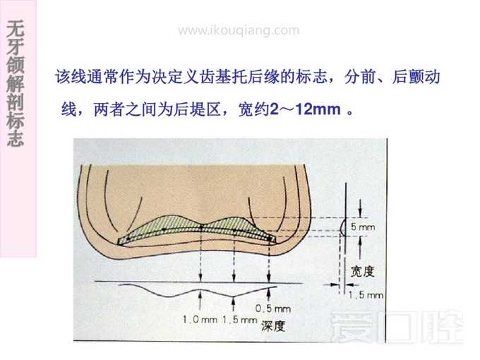 无牙颌解剖标志 25.jpg