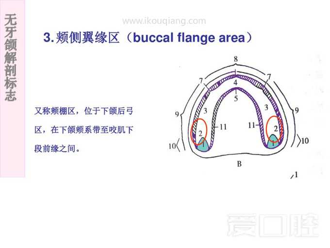 无牙颌解剖标志 31.jpg