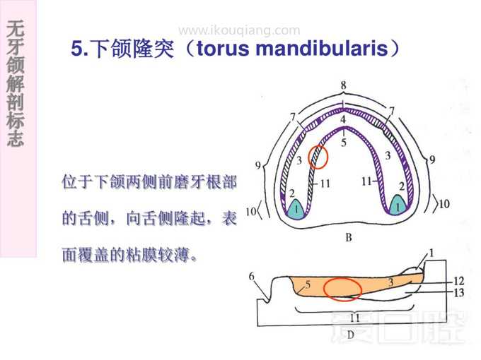 无牙颌解剖标志 37.jpg