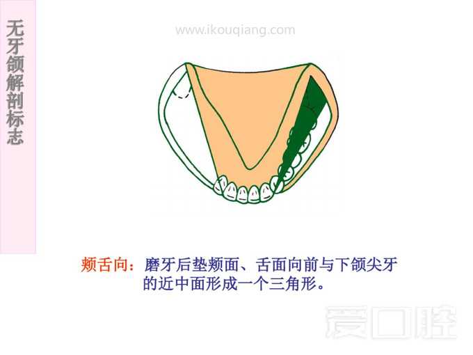 无牙颌解剖标志 43.jpg