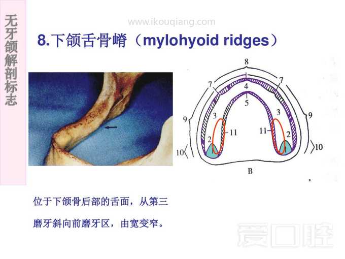 无牙颌解剖标志 46.jpg