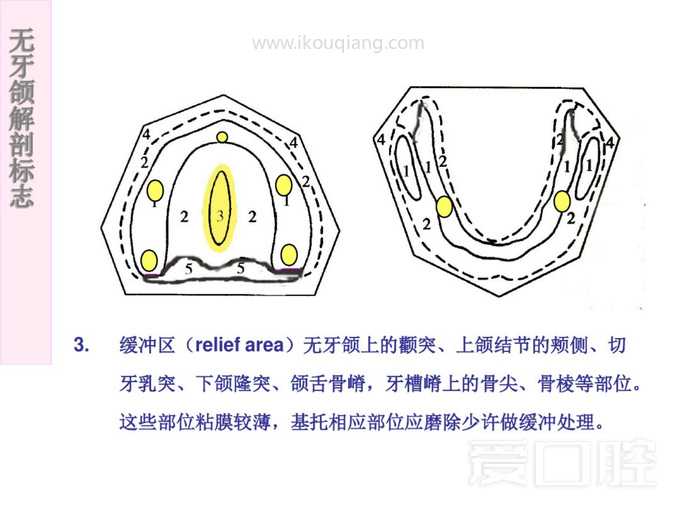 无牙颌解剖标志 54.jpg