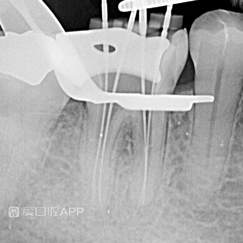 endodontics_tckw_2306602667.jpg