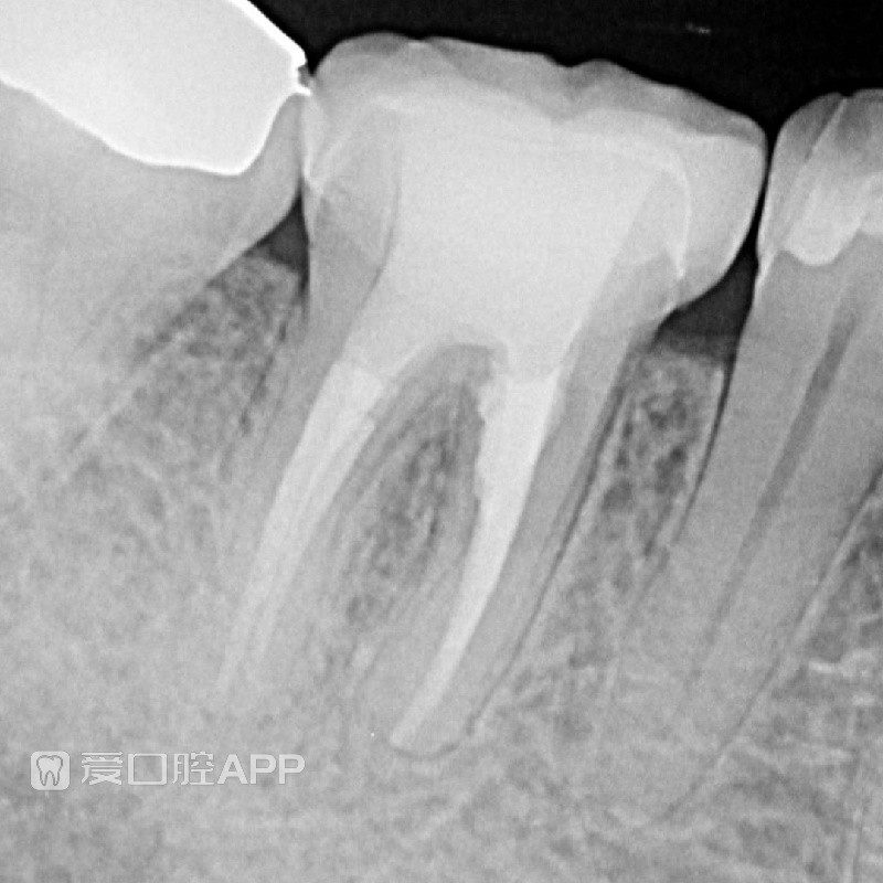 endodontics_tckw_2306602691.jpg