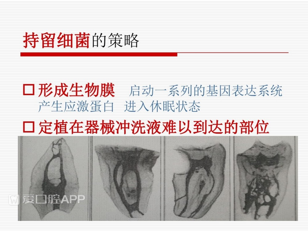 (完整版)口腔根管治疗标准化操作流程_8.jpg