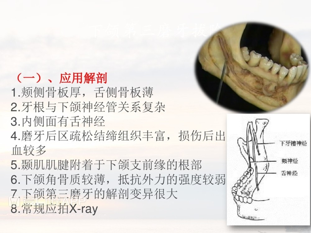 拔牙器械及操作详解_44.jpg