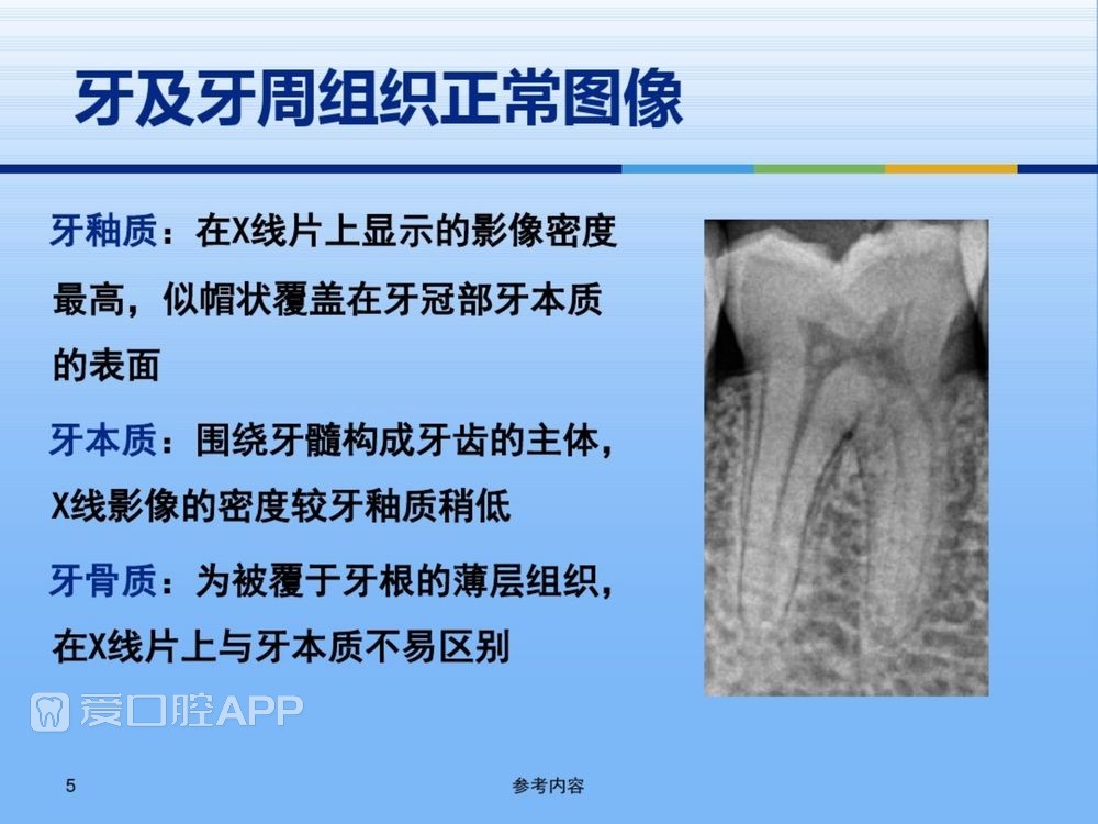 牙体牙周正常解剖及常见病X线表现(内容丰富)_5.jpg