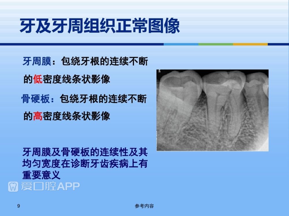 牙体牙周正常解剖及常见病X线表现(内容丰富)_9.jpg