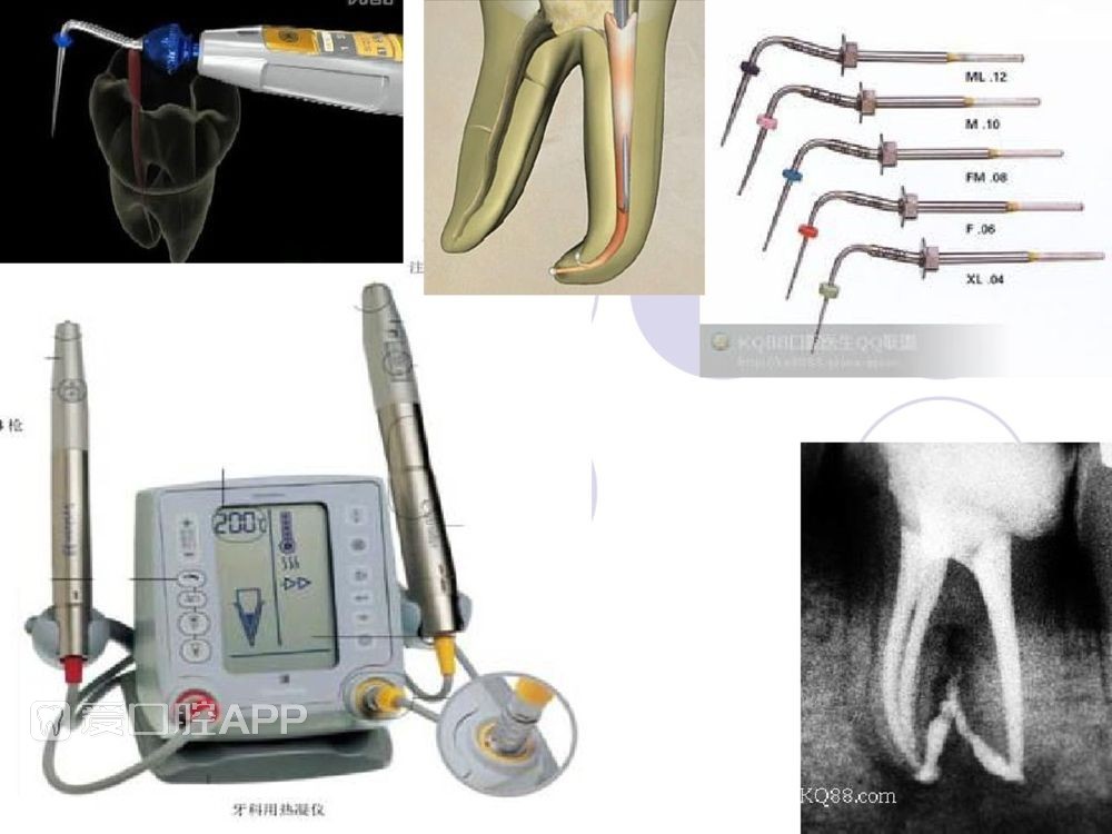 口腔科常用器械图谱、结构及功能介绍_25.jpg