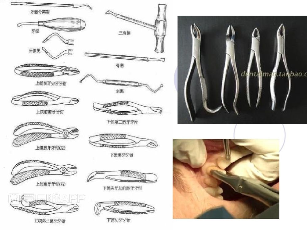 口腔科常用器械图谱、结构及功能介绍_32.jpg