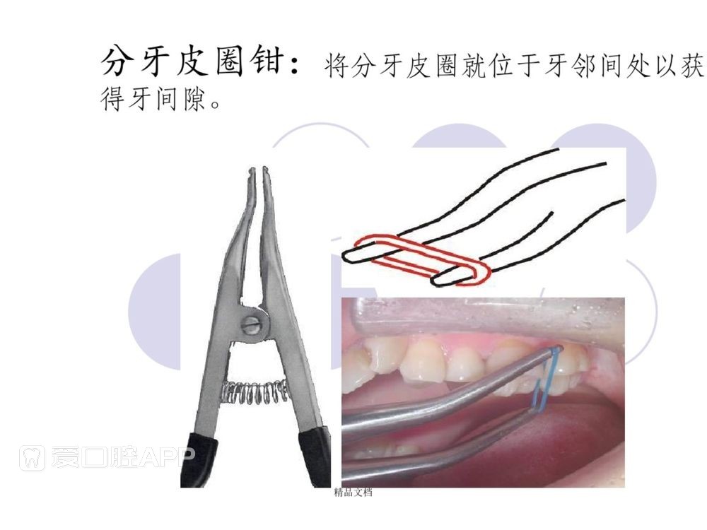 口腔科常用器械图谱、结构及功能介绍_103.jpg