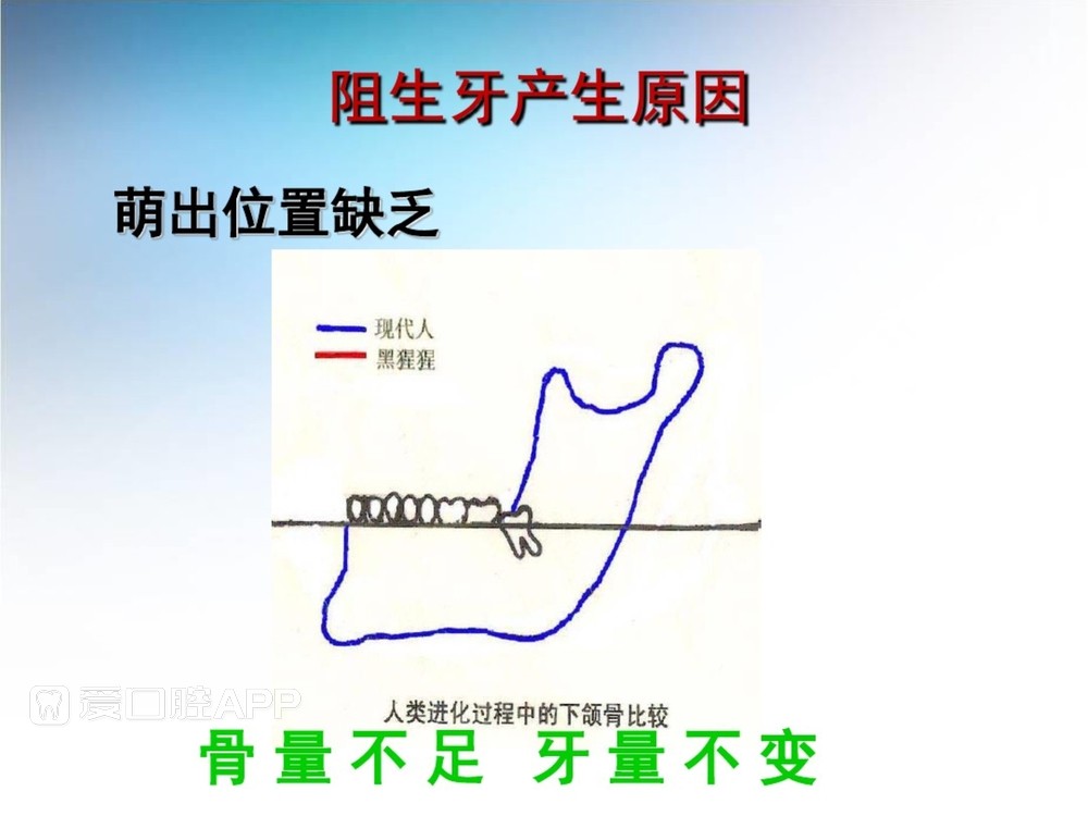 阻生牙拔除术(课堂PPT)_8.jpg